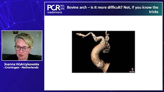 PROTECTED TAVR – Impact on Clinical Practice - Webinar
