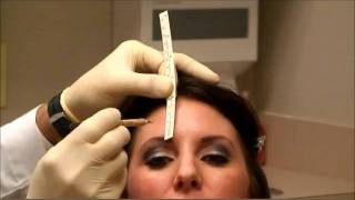 Botox Injection by Facial Plastic Surgeon Brian P Maloney in Atlanta Georgia