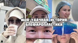 Моя Блефаропластика 2 / Блефаропластика Азиатских век / Европеизация век/ Бишкек