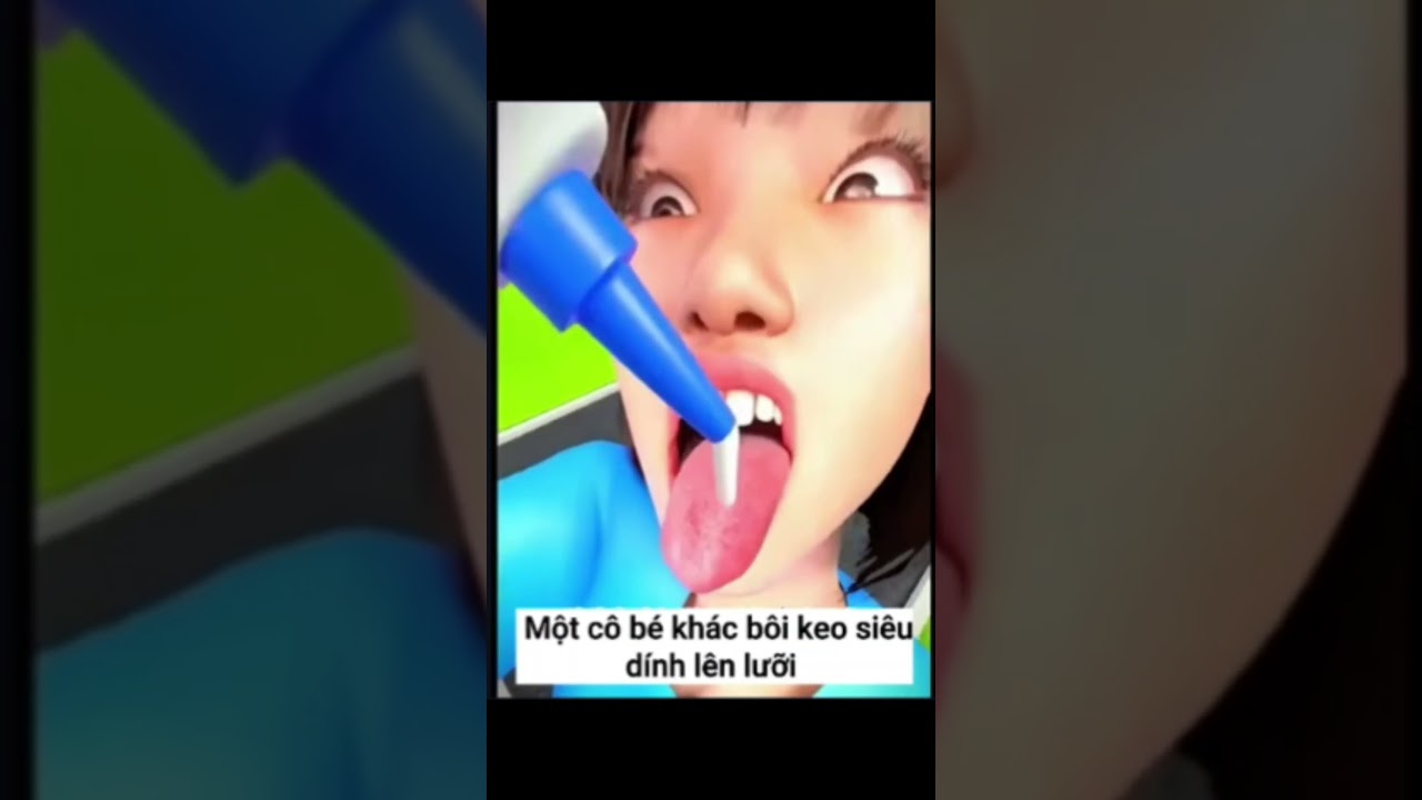 Những Tai Nạn Này Thật Đáng Sợ!!! #animation #dangso