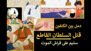 السلطان سليم على فراش الموت :دمل بين الكتفين قتل السلطان القاطع