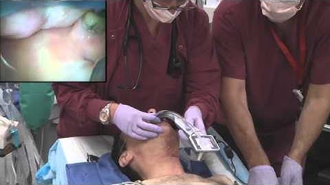 KingVision used in an awake intubation from AOD