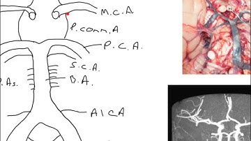 Basics of the cerebral circulation