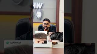 Top 2 Worst Hair Patches in India - Isse Ganda Hair Patch Nahi Ho Sakta!