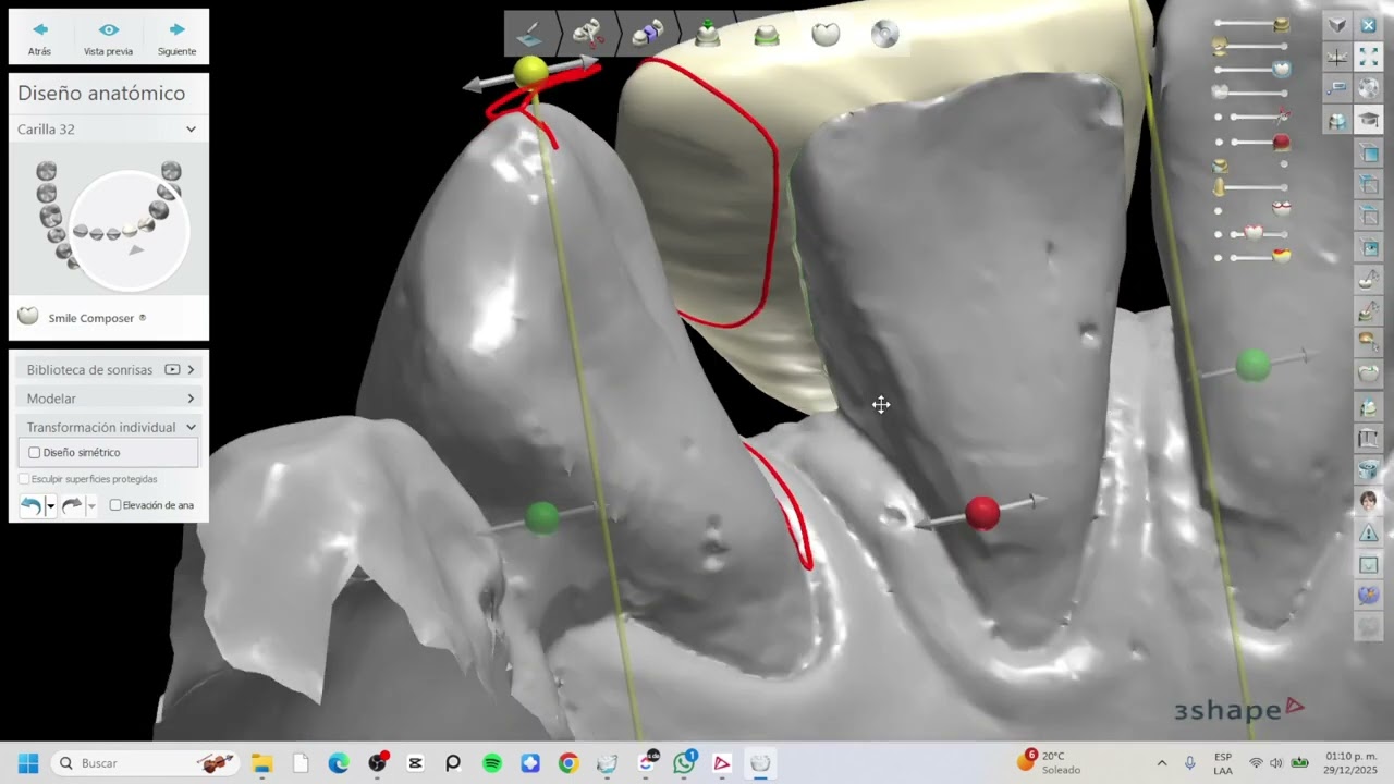 Carillas Inferiores | 3Shape