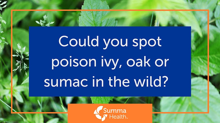 Could you spot poison ivy, oak or sumac in the wild?