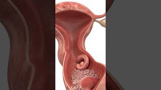Early Pregnancy Loss Explained: How the Uterus Naturally Responds | 3D Medical Animation