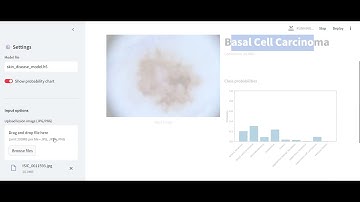 SKIN DISEASE CLASSIFICATION USING TENSORFLOW