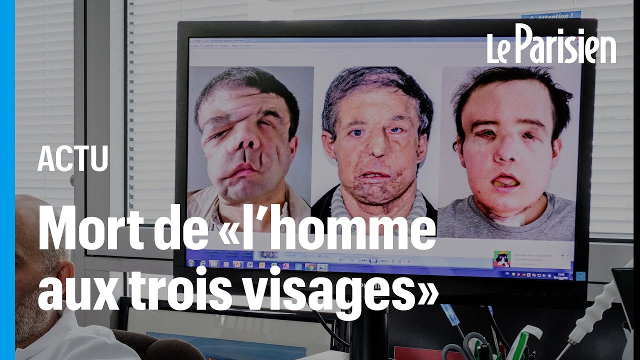 Décès de Jérôme Hamon, greffé de deux visages