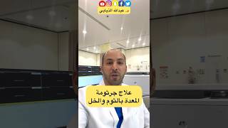 علاج جرثومة المعدة بالثوم والخل #الدكتور_الذيابي