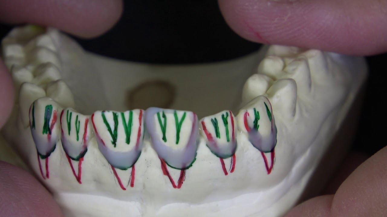 Enceramento 13 ao 23 - 1a parte   Sekito 2019