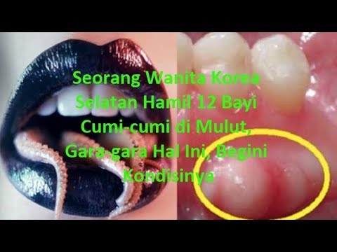 Video: Mulut Wanita Korea Telah Disenyawakan Oleh Cumi-cumi Yang Kurang Masak