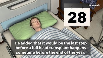 WATCH: Professor Says First Successful Human Head Transplant Using Cadavers Performed