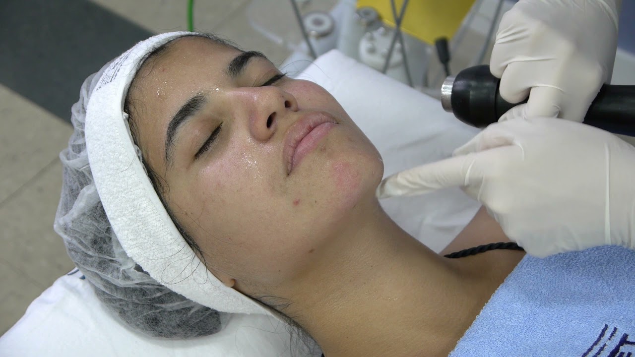 Criofrequência - Harmonização Facial não Invasiva
