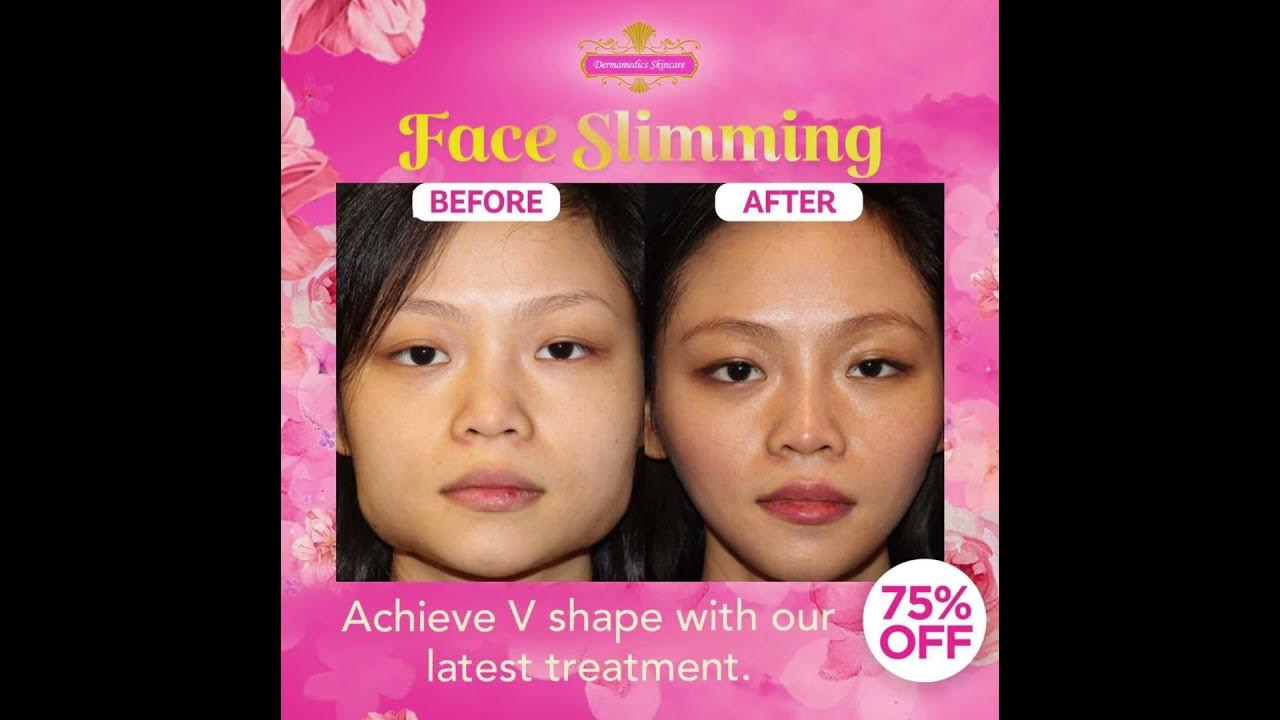 Slimming Before and After - YouTube