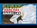 Cómo eliminar manchas amarillas de la ropa