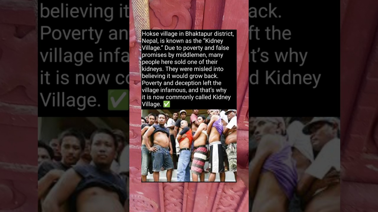 The Shocking Story of Nepal’s Kidney Village! 🥲 