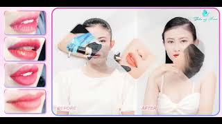 Phun Môi Tại Thẩm Mỹ Hana