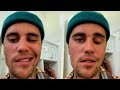 New Update!! Heartbreaking News Of Justin Bieber || It Will Really Shock You Much