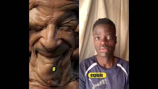 What To Do If You Ever Step On A Sea Urchin