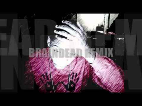 icez brain dead icez brain dead