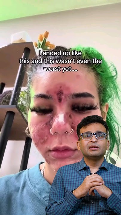 this-is-what-happens-if-you-use-expired-skincare-products-on-your-face