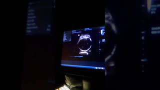 Sonograma de Valentina 7 mdg