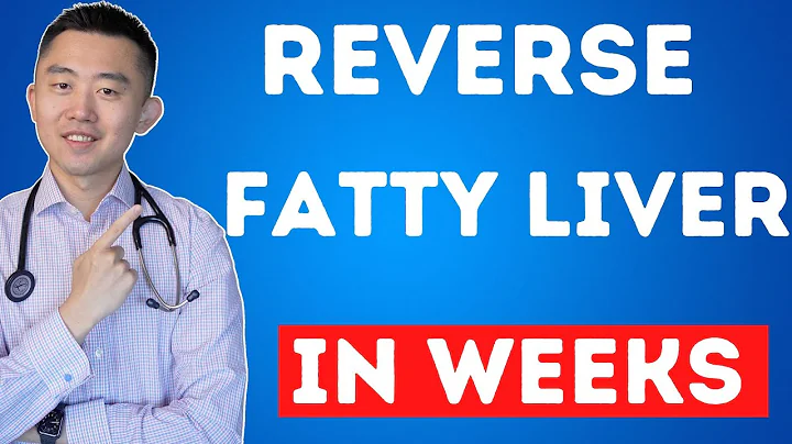 The FASTEST Way to Reverse Fatty Liver, Naturally | NAFLD Treatment - DayDayNews