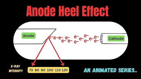 Anode Heel effect ll Animated series ll radiography simplified