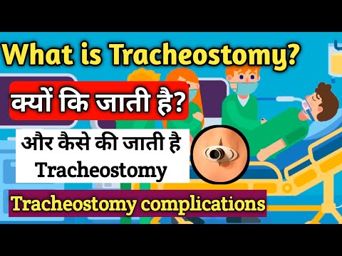 tracheostomy patient | what is tracheostomy | tracheostomy procedure