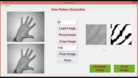 Vein Pattern Extraction from Gray Scaled Images