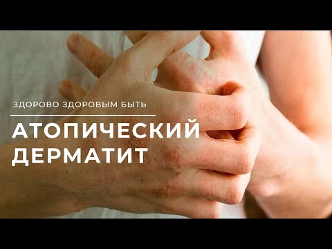 Видео: Може ли атипичната лобуларна хиперплазия да изчезне?