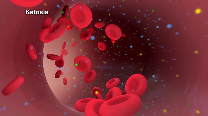 Understanding Diabetes, Dr. Kristi Sutton, CHI St....