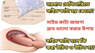 নরমাল ডেলিভারিতে সাইড কাটা দ্রুত ভালো হয় কিভাবে?|| সাইড কাটার যত্ন কিভাবে নিতে হয়?|| Episiotomy