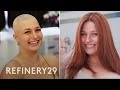 Styling Wigs With Alopecia | Hair Me Out | Refinery29