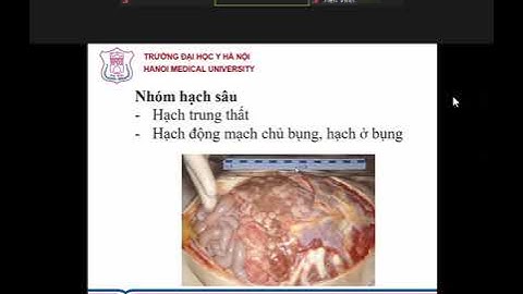 Khám hạch ở bệnh viện nào hà nội