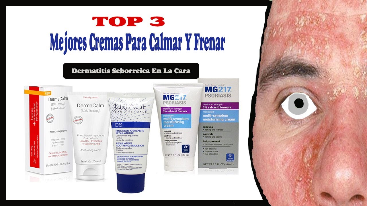 Dermatitis Seborreica Cremas frenarla - YouTube