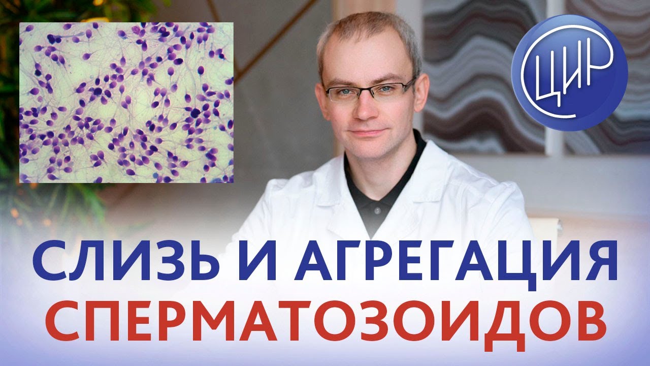 Слизь и агрегация сперматозоидов - что это значит? Спермограмма. Расшифровка спермограммы.