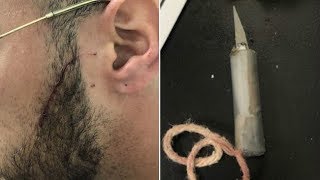 Rikers Island correction officer slashed by gang member, union says
