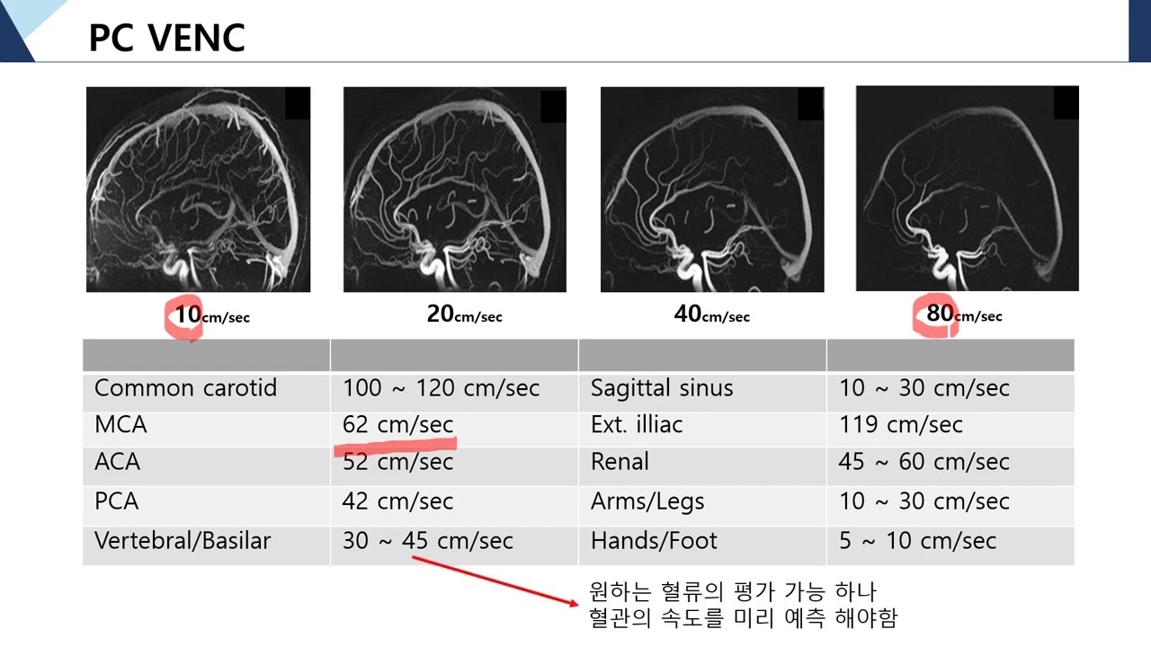 6. Phase Contrast (PC) - Velocity Encoding