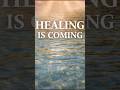 This Prayer Is for Your Healing 🙏 | Jesus Heals #shorts
