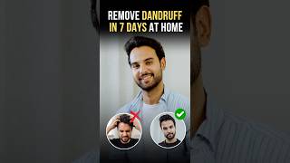 Remove Dandruff in 7 Days | Dandruff Kaise Hataye? | Home Remedies for Dandruff (100% Effective)