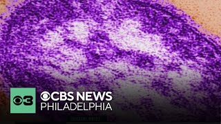 Philadelphia reports measles case, Mayor Parker to deliver budget address and more | Digital Brief