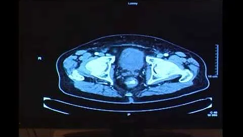Dr. Jennifer Davila-Aponte, Urology Resident at UVA
