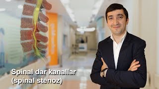 PhD, Uzm Dr. Fərid Qaralov İxtisas: Neyrocərrah Mövzu: Spinal dar kanallar (spinal stenoz)