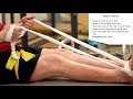 Knee Replacement - Knee Exercises