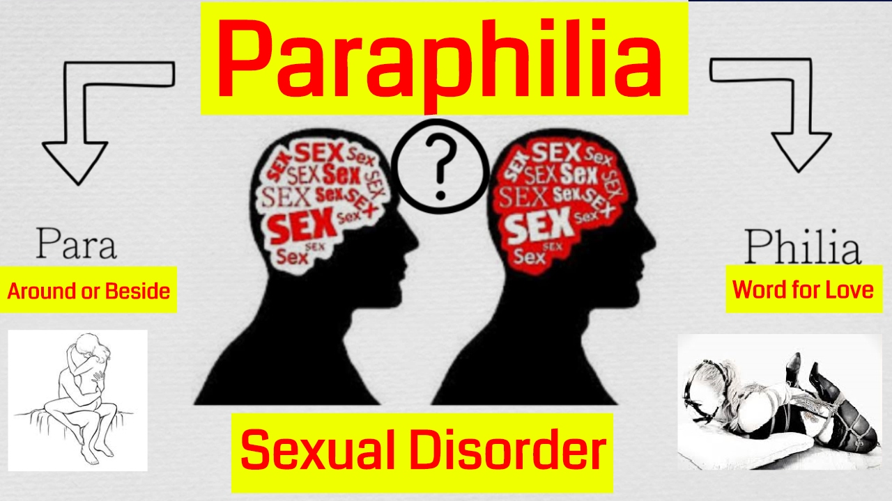 Paraphilia And Paraphilic Culture We Can And We Can Not Strictly