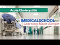 Acute cholecystitis gallbladder attack made simple