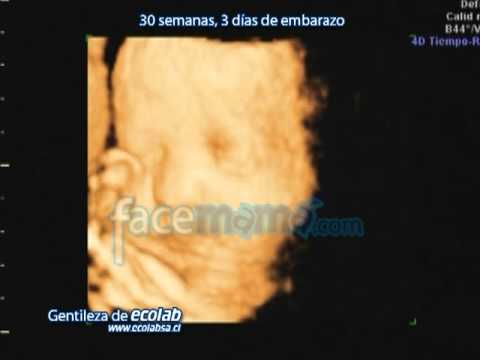 embarazo de 20 semanas y 3 dias embarazo de 20 semanas y 3 dias