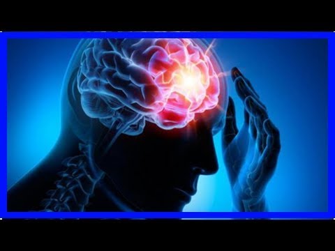 Video: 8 Möglichkeiten, Kopfschmerzen auf natürliche Weise loszuwerden
